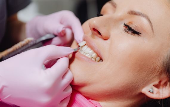 curso practico carillas dentales bilbao